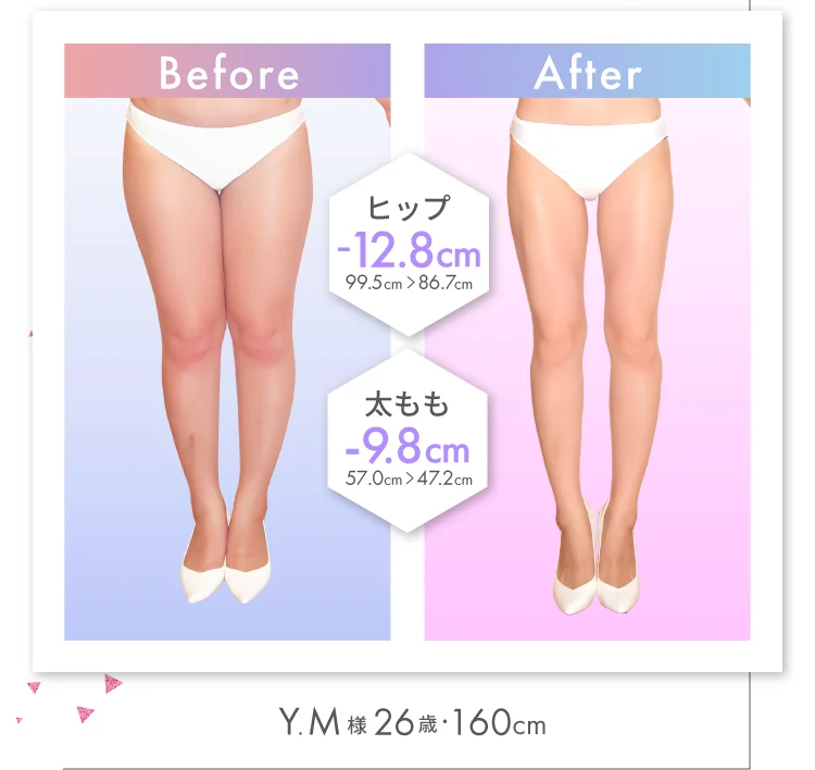 太もも -9.8cm！ Y.M様（26歳・160cm）
                Before-After ヒップ -12.8cm！ 99.5cm → 86.7cm 太もも -9.8cm！ 57.0cm → 47.2cm