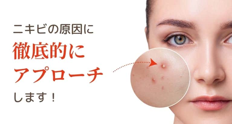 「ニキビの悩みに特化」イメージ画像