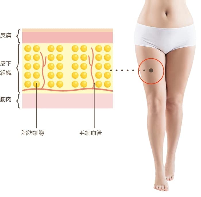 正常な皮下組織のイメージ